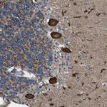 TOM70 Antibody in Immunohistochemistry (Paraffin) (IHC (P))