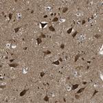 TOM70 Antibody in Immunohistochemistry (Paraffin) (IHC (P))