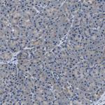 TOM70 Antibody in Immunohistochemistry (Paraffin) (IHC (P))