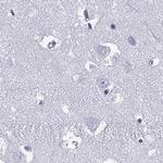 Connexin 50 Antibody in Immunohistochemistry (Paraffin) (IHC (P))
