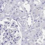 Connexin 50 Antibody in Immunohistochemistry (Paraffin) (IHC (P))