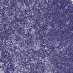 NEFL Antibody in Immunohistochemistry (Paraffin) (IHC (P))