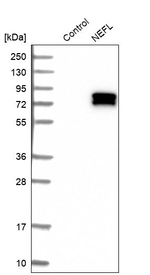 NEFL Antibody in Western Blot (WB)