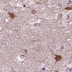 PRLH Polyclonal Antibody