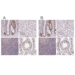 PTPN2 Antibody in Immunohistochemistry (Paraffin) (IHC (P))