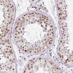 PTPN2 Antibody in Immunohistochemistry (Paraffin) (IHC (P))