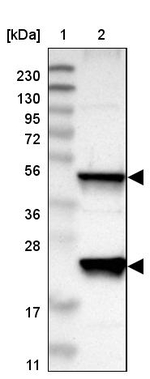 PTPN2 Antibody in Western Blot (WB)