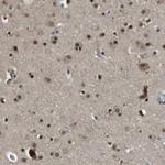 ORAI3 Antibody in Immunohistochemistry (Paraffin) (IHC (P))