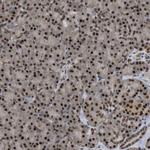 ORAI3 Antibody in Immunohistochemistry (Paraffin) (IHC (P))