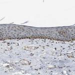 ORAI3 Antibody in Immunohistochemistry (Paraffin) (IHC (P))