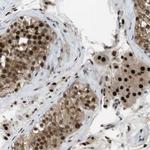 ORAI3 Antibody in Immunohistochemistry (Paraffin) (IHC (P))