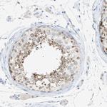 SLC25A31 Antibody in Immunohistochemistry (Paraffin) (IHC (P))