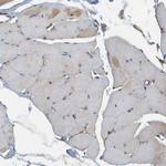 SGMS2 Antibody in Immunohistochemistry (Paraffin) (IHC (P))