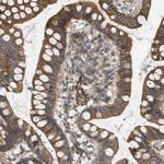 SGMS2 Polyclonal Antibody