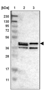 SGMS2 Antibody in Western Blot (WB)
