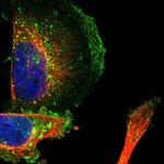 SLC30A1 Polyclonal Antibody