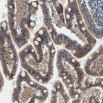 SLC30A1 Antibody in Immunohistochemistry (Paraffin) (IHC (P))