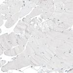 HLTF Antibody in Immunohistochemistry (Paraffin) (IHC (P))