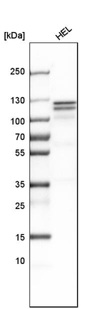 HLTF Antibody in Western Blot (WB)