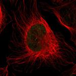 MYH11 Polyclonal Antibody