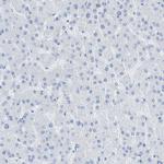 MYH11 Antibody in Immunohistochemistry (Paraffin) (IHC (P))