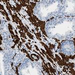 MYH11 Antibody in Immunohistochemistry (Paraffin) (IHC (P))