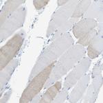 MYH11 Antibody in Immunohistochemistry (Paraffin) (IHC (P))