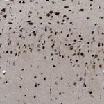 PRKX Antibody in Immunohistochemistry (Paraffin) (IHC (P))