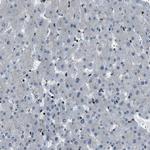 PRKX Antibody in Immunohistochemistry (Paraffin) (IHC (P))