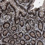 PRKX Antibody in Immunohistochemistry (Paraffin) (IHC (P))