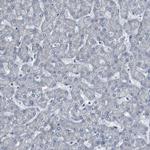 PRAK Antibody in Immunohistochemistry (Paraffin) (IHC (P))