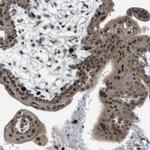 PRAK Antibody in Immunohistochemistry (Paraffin) (IHC (P))