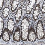 PRAK Antibody in Immunohistochemistry (Paraffin) (IHC (P))