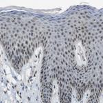 PRAK Antibody in Immunohistochemistry (Paraffin) (IHC (P))