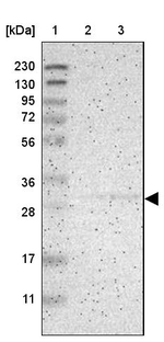 KCNMB3 Antibody in Western Blot (WB)