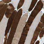 RASGRP2 Polyclonal Antibody