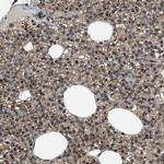 PERK Polyclonal Antibody