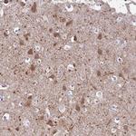 DCAMKL2 Antibody in Immunohistochemistry (Paraffin) (IHC (P))