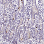DCAMKL2 Polyclonal Antibody