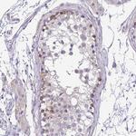 DCAMKL2 Antibody in Immunohistochemistry (Paraffin) (IHC (P))