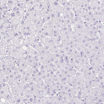 DCAMKL2 Antibody in Immunohistochemistry (Paraffin) (IHC (P))
