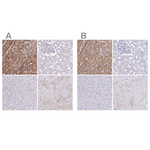 Cardiac Troponin T Polyclonal Antibody