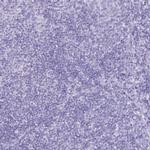 Defensin 5 Antibody in Immunohistochemistry (Paraffin) (IHC (P))