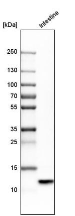 Defensin 5 Antibody in Western Blot (WB)