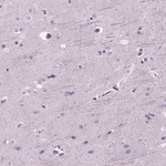 Recoverin Antibody in Immunohistochemistry (Paraffin) (IHC (P))