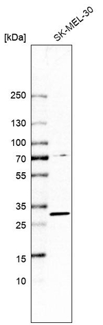 PRPK Antibody in Western Blot (WB)