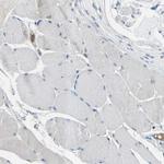 delta Catenin Polyclonal Antibody