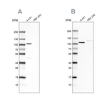 delta Catenin Antibody in Western Blot (WB)