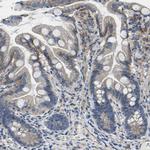 delta Catenin Antibody in Immunohistochemistry (Paraffin) (IHC (P))