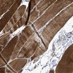 SIK2 Antibody in Immunohistochemistry (Paraffin) (IHC (P))